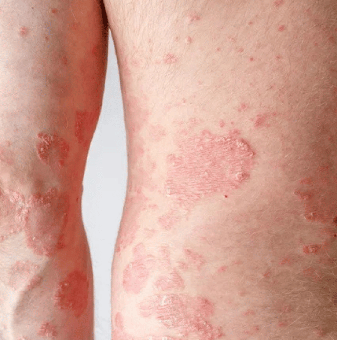 dramorgana dermatologia campo mourao 12
