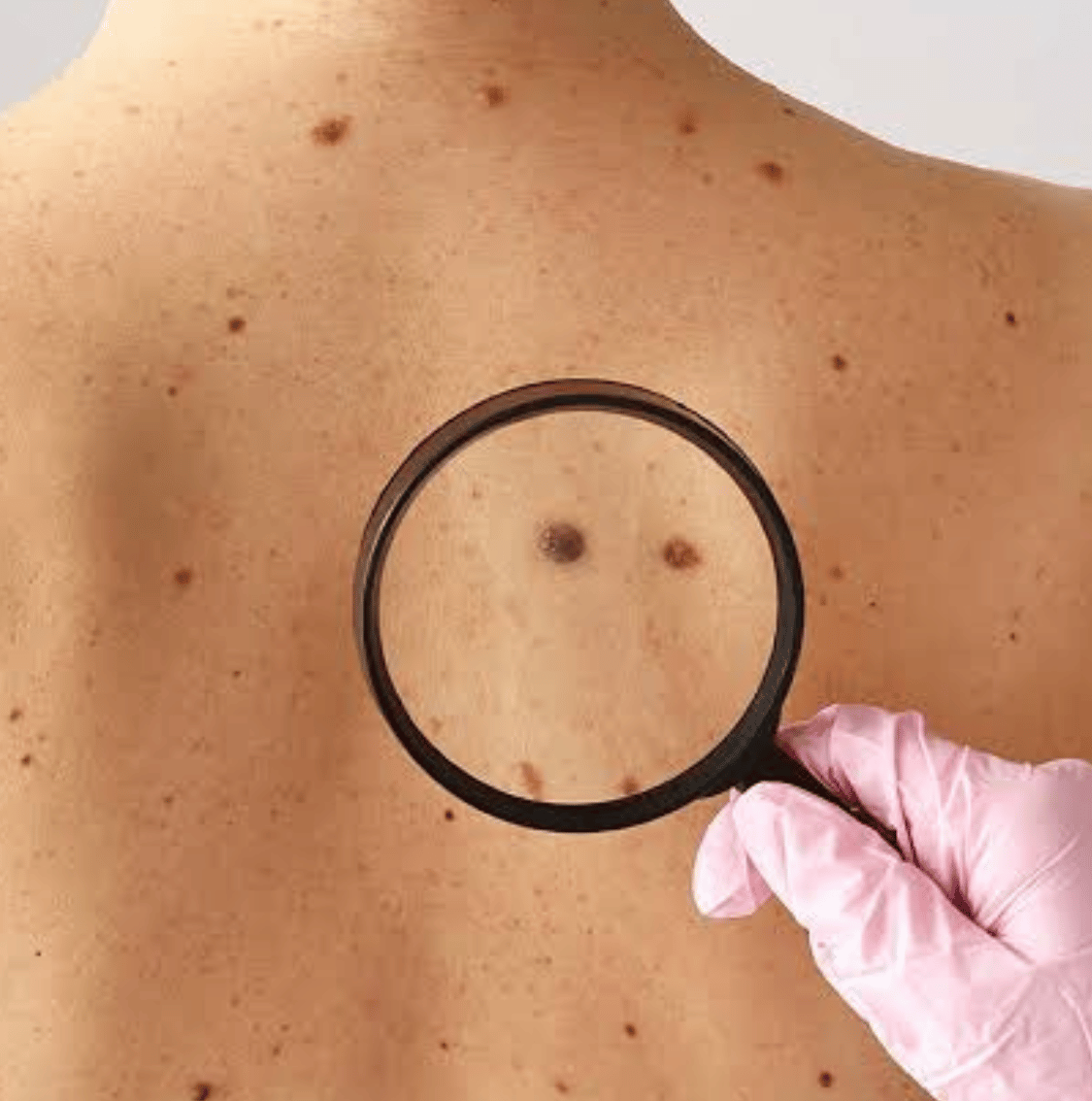 dramorgana dermatologia campo mourao 18