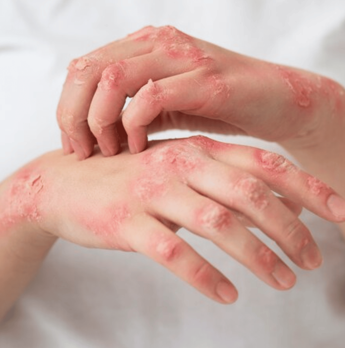 dramorgana dermatologia campo mourao 24